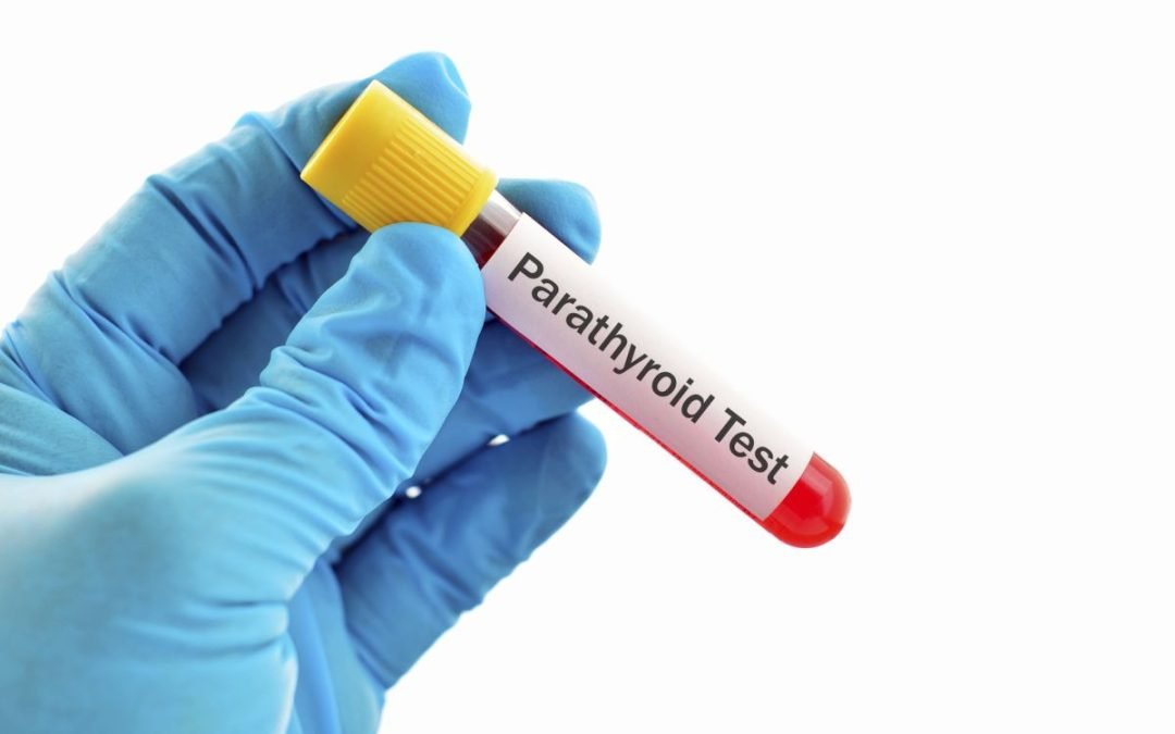 Diseases of the parathyroid glands – Part 2 hyperparathyroidism