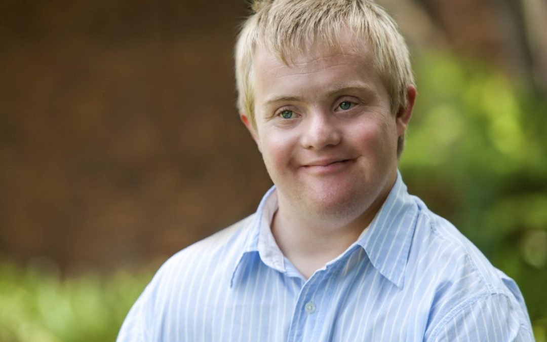 Hypothyroidism and Down’s Syndrome